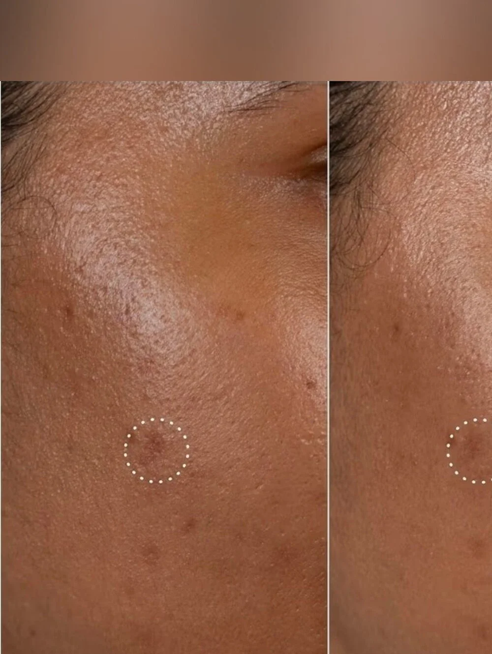 Hero Dark Spot Correct Spot‑Fading Vitamin C Serum Pen — 0.34fl Oz BNIB